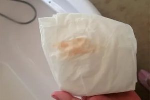 Светло-бежевые выделения от утрожестана