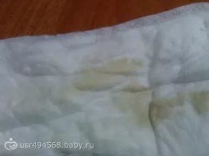 Светло-бежевые выделения от утрожестана