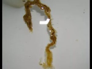 Серые пленки в кале