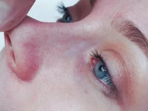 Под кожей века вена?