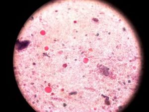 BLASTOCYSTIS HOM