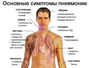 Кашель, боль в горле, температура 37 и 2, слабость, потливость