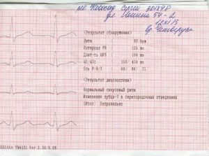 Срок годности ЭКГ с нагрузкой