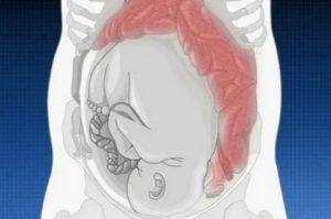 Кишечник или беременность