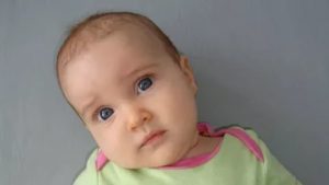 Ребенок держит голову на бок