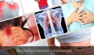 Вертеброгенная торакалгия не проходит. Что делать?