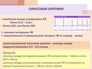 Сбой сердечного ритма два удара с 2-х секундной паузой минуту