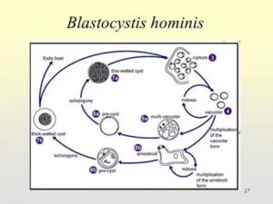 BLASTOCYSTIS HOM