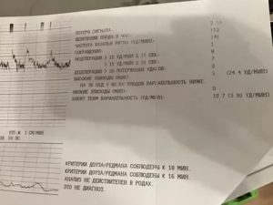 Нормы потери сигнала на ктг?