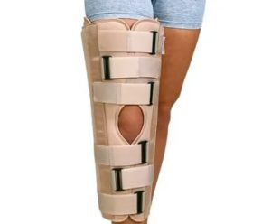 Ортез или гипс