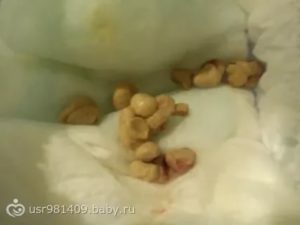 Ребенок не какает третий день