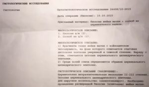 Расшифровка биопсии шейки матки, дисплазия 3 степени