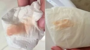 Розовые выделения после полового акта