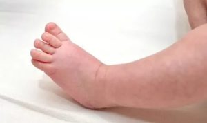 Ребенок резко побледнел, упала температура, холодные конечности