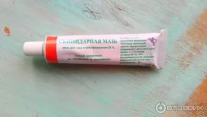 Температура 37,5 намазали скипидарной мазью, последствия