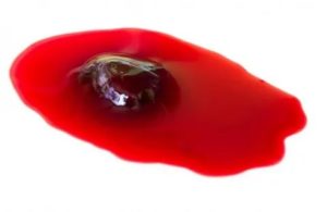 Кровеподобные выделения на фоне приема силует