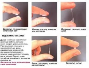 Зуд и жжение у партнерши после полового акта, причины