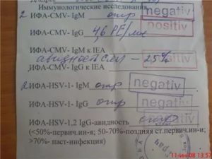 Положительный ИФА на сифилис при беременности 33 недели