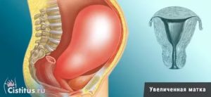Увеличена матка
