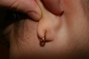 Темно синее образование возле прокола уха