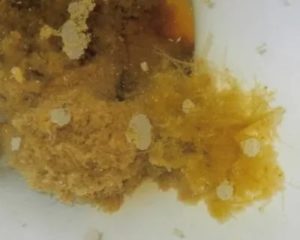 Красные пятнышки в кале