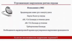 Сбой сердечного ритма два удара с 2-х секундной паузой минуту