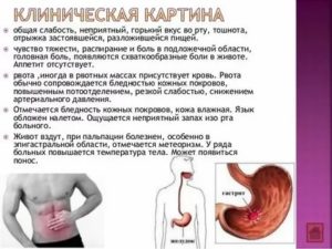 Симптомы: тошнота, боль в желудке, отрыжка, температура,