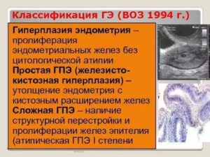 Рецидив очаговая базальная гиперплазия эндометрия, эндометриоз