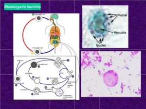 BLASTOCYSTIS HOM
