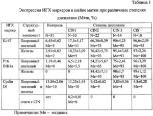 Расшифровка биопсии шейки матки, дисплазия 3 степени