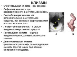 Продолжительный запор, клизмы не помогают