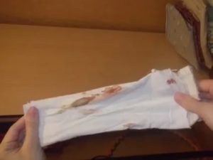 Беременность 10 недель, красные выделения