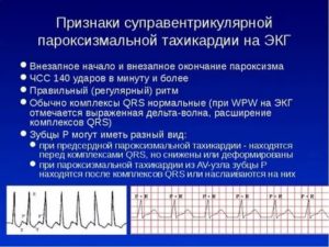 Сбой сердечного ритма два удара с 2-х секундной паузой минуту