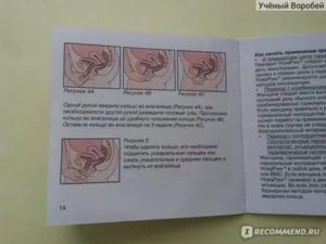 Новаринг менструация