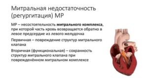 Недостаточность аортального клапана: фиброз створок, регургитация до 2-3 степени
