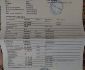 Анализы назначенные лором