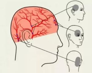 Тупая постоянная боль между правым виском и ухом
