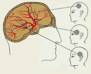 Тупая постоянная боль между правым виском и ухом