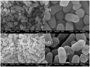 Нужен ли антибиотик? Streptococcus gr. Viridans, Enterobacter aerogenes10(5)